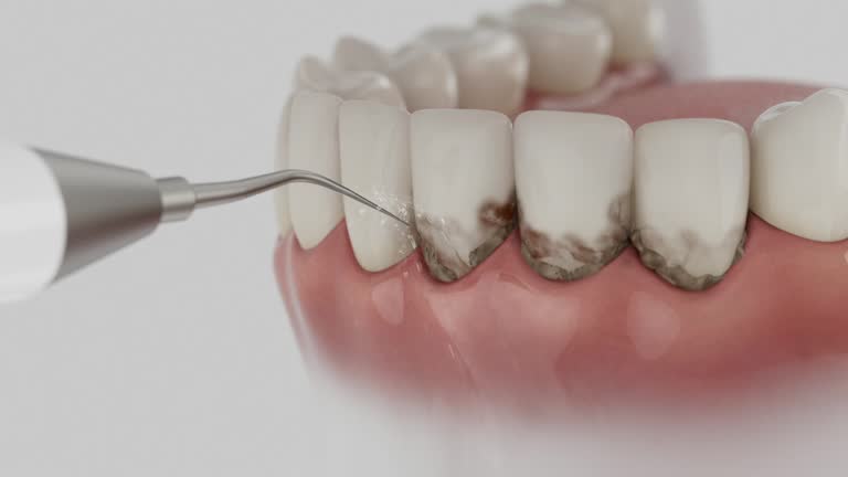 Reliable Emergency Dentist contractor in Corunna, MI by Smile Center Dentistry